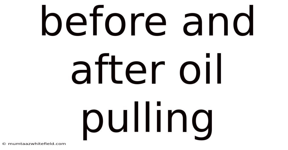 Before And After Oil Pulling