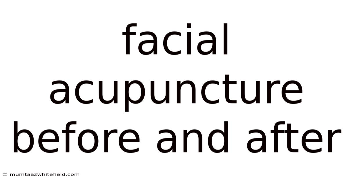 Facial Acupuncture Before And After