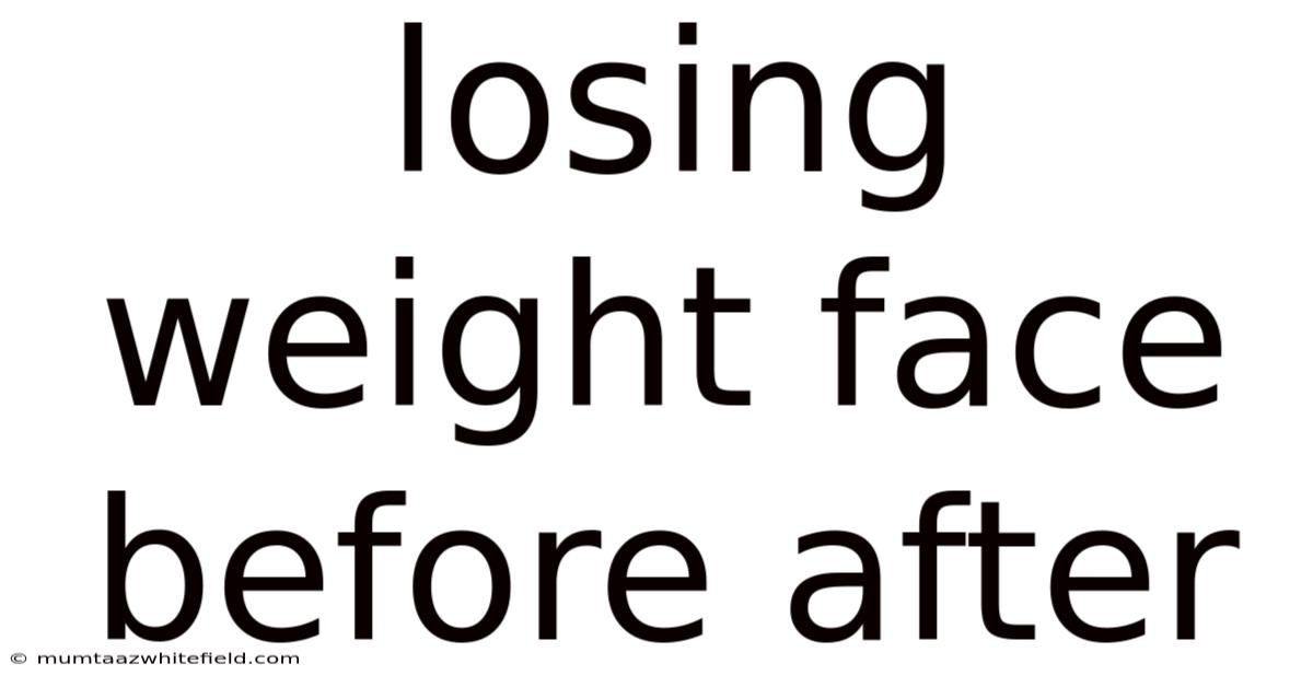 Losing Weight Face Before After